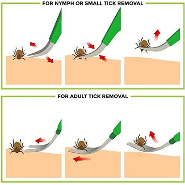 Advanced Tick Removal Tool