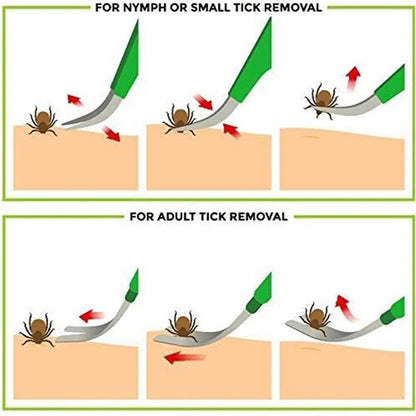 Advanced Tick Removal Tool