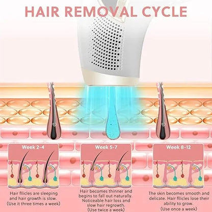 Laser Hair Removal