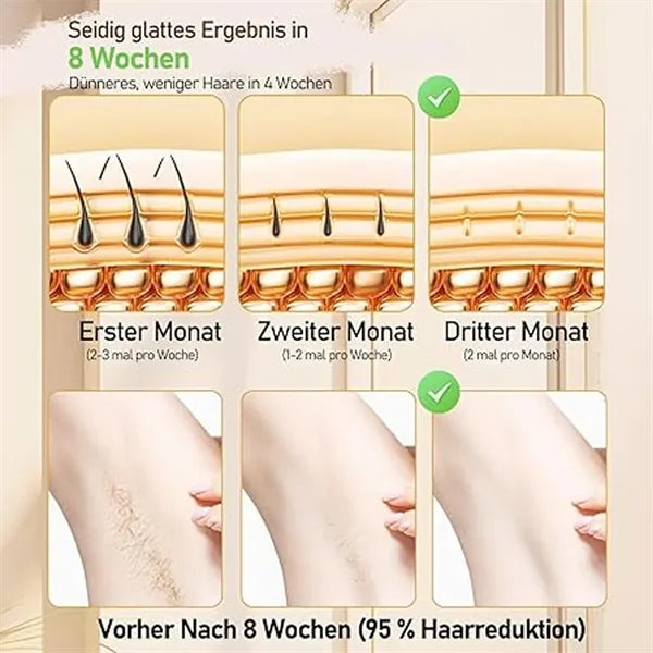 Laser Hair Removal