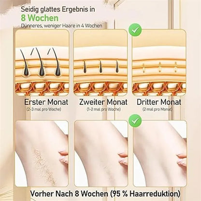 Laser Hair Removal