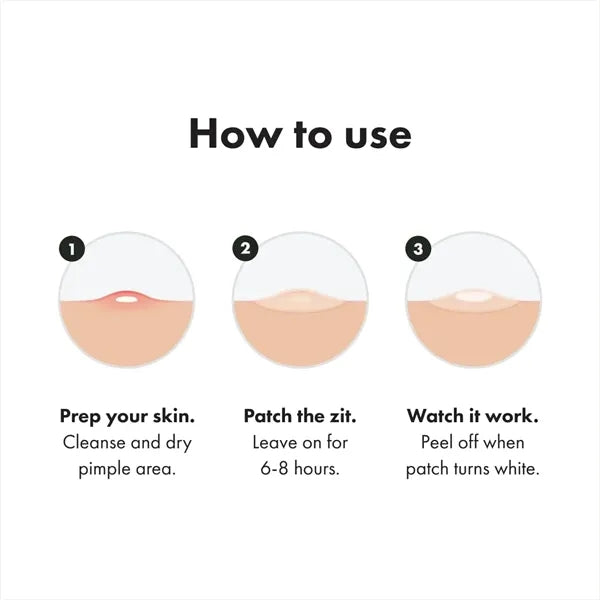 Invisible Acne Patch - Fast & Gentle Treatment