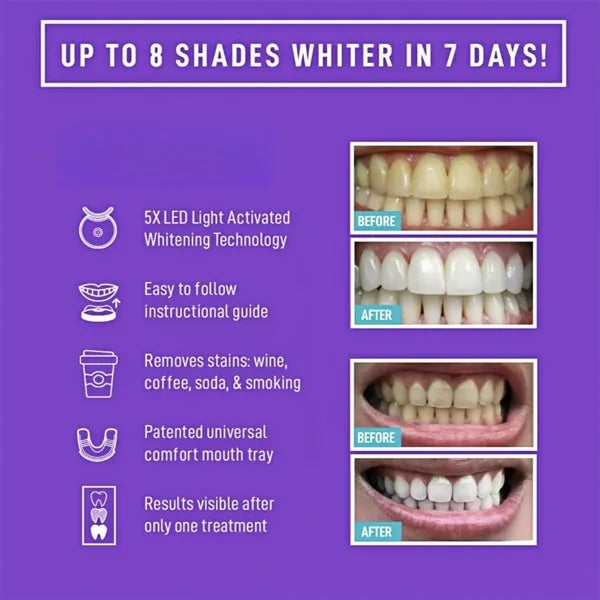 Teeth Whitening Kit LED Light 35 Percent Carbamide Gel Syste