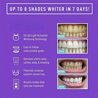 Teeth Whitening Kit LED Light 35 Percent Carbamide Gel Syste