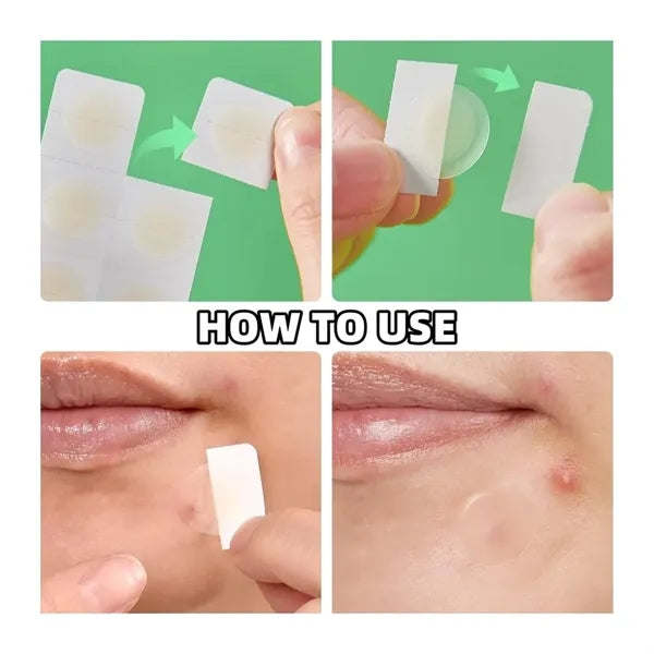 Micro Needle Pimple Patch