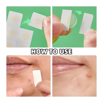 Micro Needle Pimple Patch