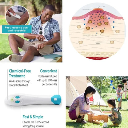 Physical Portable Mosquito Bite Itch Relief Pen