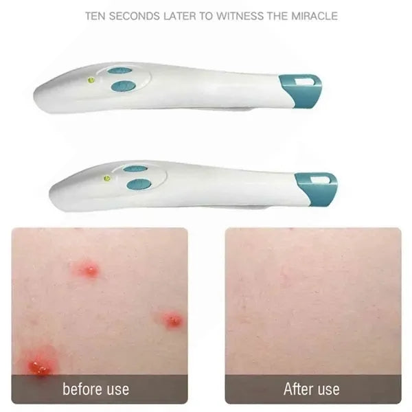 Portable Mosquito Bite Itching Pen