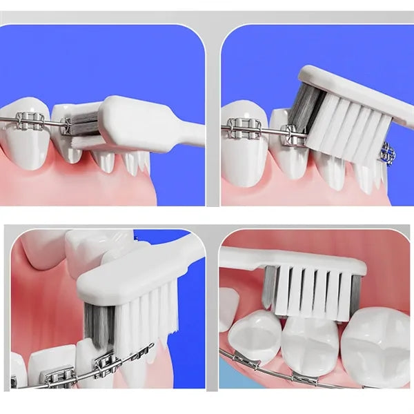 Travel DetachableSoft BristleToothbrush